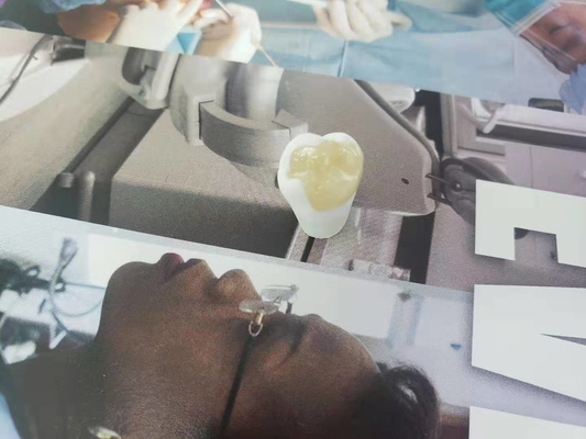 Sobrepuesto dental totalmente de cerámica durable del embutido de la chapa de la corona del FDA similar
