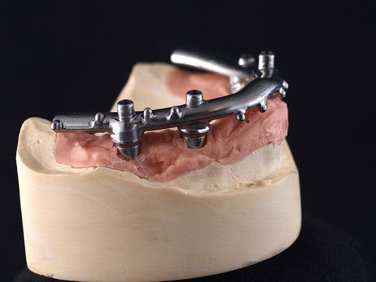 El implante del CNC del titanio All-On-4 aseguró las dentaduras para la clínica dental