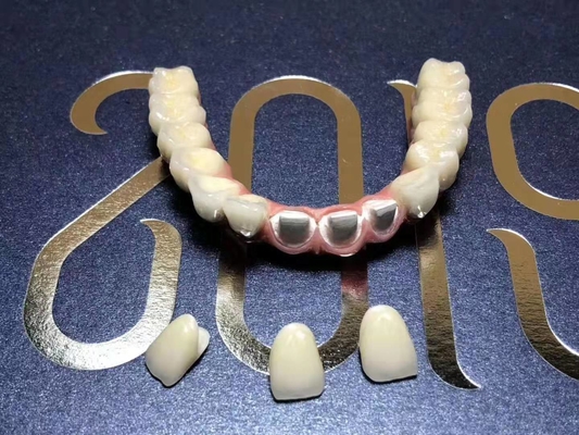 Corona dental desprendible del titanio individual flexible para la clínica dental