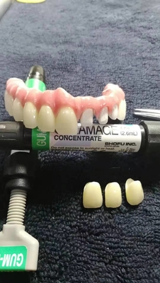 Corona dental desprendible del titanio individual flexible para la clínica dental