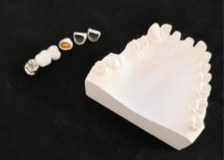 Resistencia a la corrosión completa modificada para requisitos particulares del metal de la corona dental de la porcelana de PFM