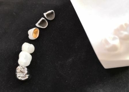 Resistencia a la corrosión completa modificada para requisitos particulares del metal de la corona dental de la porcelana de PFM
