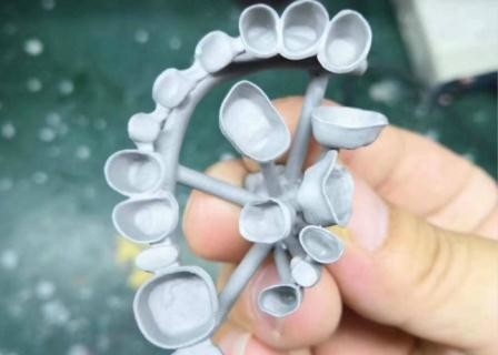 Resistencia a la corrosión completa modificada para requisitos particulares del metal de la corona dental de la porcelana de PFM