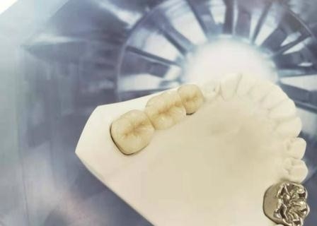Corona dental de pulido alto Intermiscibility biológico de la porcelana del OEM