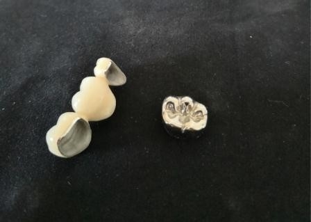 Corona dental de pulido alto Intermiscibility biológico de la porcelana del OEM