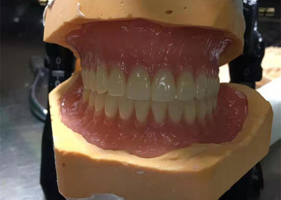 CAD-CAM que 3D de goma imprimió las coronas son fáciles de mantener y de caber