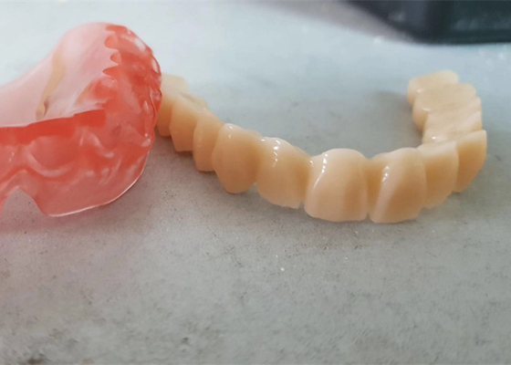 El OEM realista 3D de los datos de Digitaces imprimió los modelos dentales para el dentista Study