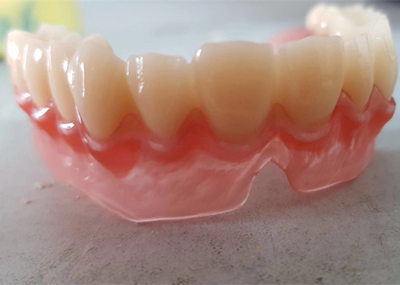 El OEM realista 3D de los datos de Digitaces imprimió los modelos dentales para el dentista Study