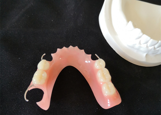 Superficie lisa dental de la estabilidad del color del alto puente de la definición PFM