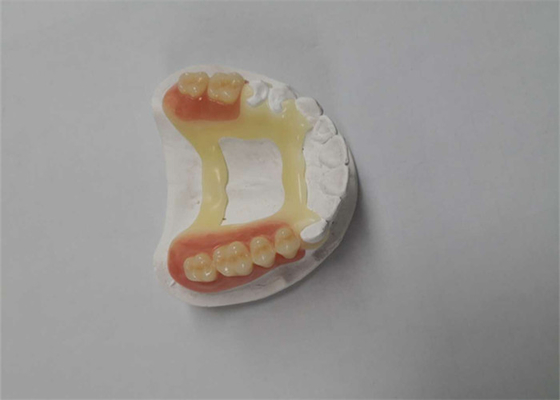 Impresora dental de goma Dental Laboratory de la corona 3D de la mirada natural PFM