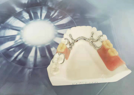 Cocr Chrome echó dureza fuerte limpia fácil de la corona dental desprendible