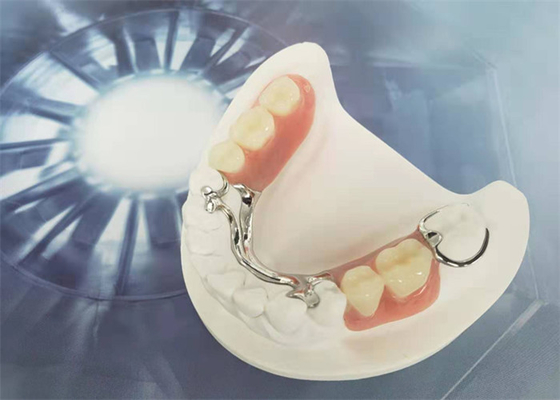 Cocr Chrome echó dureza fuerte limpia fácil de la corona dental desprendible