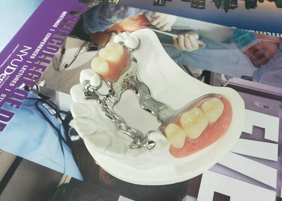 Natrural sombrea 3D que imprime la dentadura desprendible fija para el dentista Study