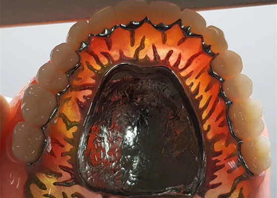 Corona dental desprendible del OEM de la seguridad de alta intensidad para el dentista Study