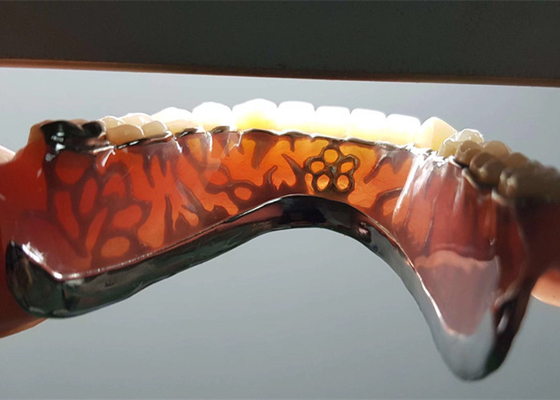 Corona dental desprendible del OEM de la seguridad de alta intensidad para el dentista Study