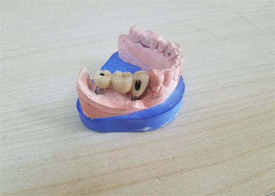 Corona dental de la circona de la leva del cad con el contrafuerte de la circona de la base del titanio