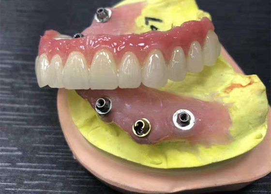 Corona dental de la circona del contrafuerte del implante natural todo en cuatro dentaduras