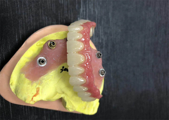 Corona dental de la circona del contrafuerte del implante natural todo en cuatro dentaduras