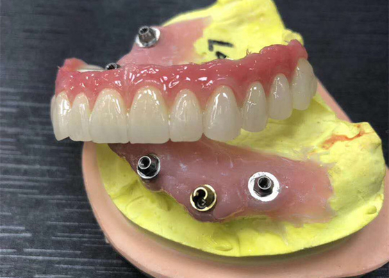 Corona dental de la circona del contrafuerte del implante natural todo en cuatro dentaduras