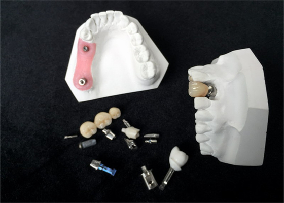 Alta corona del implante dental de la circona de la durabilidad para la restauración dental