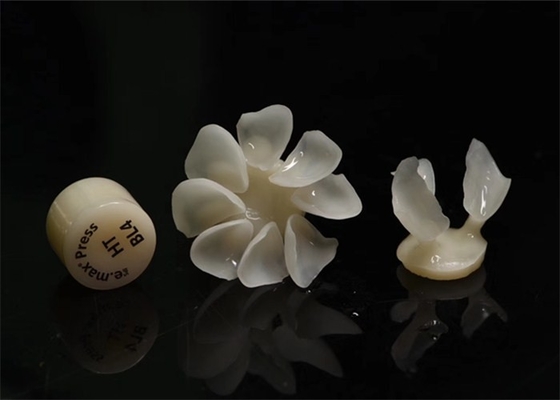 Las chapas compuestas dentales de Durablity CAD-CAM detallaron altamente exacto