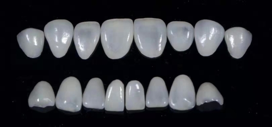 Las chapas compuestas dentales de Durablity CAD-CAM detallaron altamente exacto