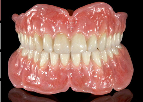 La dentadura parcial de la corona dental desprendible de goma flexible fácil mantiene