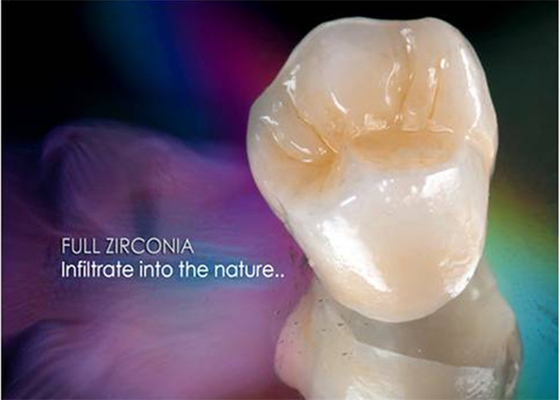 Chapee ultra difícilmente las dentaduras de pulido del implante de la corona totalmente de cerámica dentales