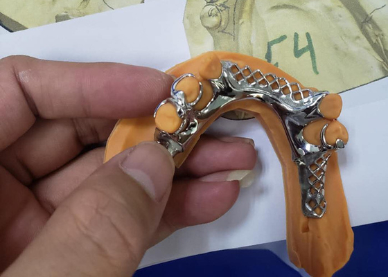 El puente dental flexible de la corona de Digitaces PFM fácil mantiene ultra difícilmente