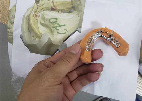 El puente dental flexible de la corona de Digitaces PFM fácil mantiene ultra difícilmente