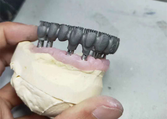 Impresora durable Dental Lab Prints de la leva PFM 3D del cad para la investigación