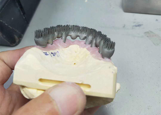Impresora durable Dental Lab Prints de la leva PFM 3D del cad para la investigación