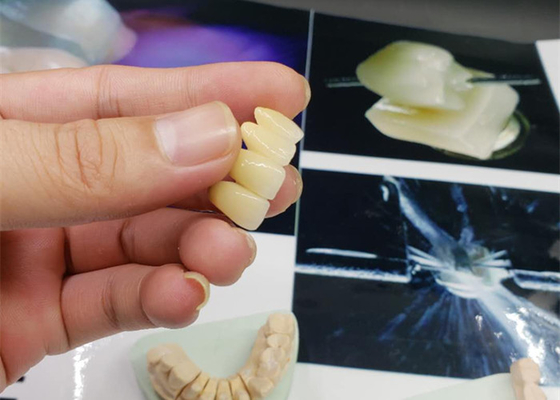 Corona resistente a la corrosión de la porcelana del OEM de la seguridad toda la mirada natural de cerámica