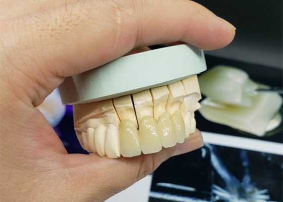 Corona resistente a la corrosión de la porcelana del OEM de la seguridad toda la mirada natural de cerámica