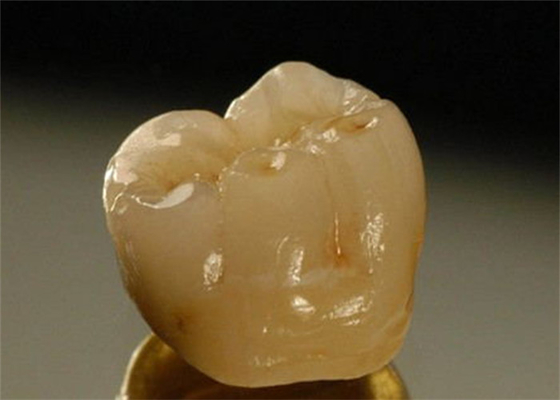 Corona dental de la porcelana inter de la miscibilidad