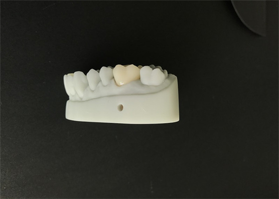 El OEM 3D imprimió el diseño dental de la leva de los modelos cad para el laboratorio de la dentadura