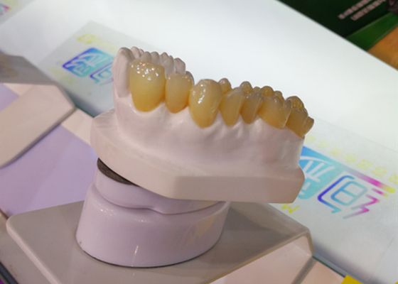 Impresora dental Dental Crowns del laboratorio 3D de la corona del diseño PFM de la leva del cad