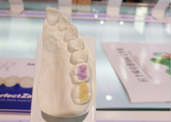 Corona totalmente de cerámica dental de encargo de alta densidad de encargo de la cerámica FDA
