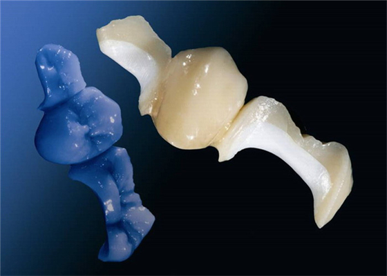 OEM modificado para requisitos particulares que pule el sobrepuesto dental totalmente de cerámica del embutido de la chapa de la corona