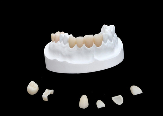 Chapas compuestas de la porcelana del IPS E Max Ceramic Dental Crown Comfortable