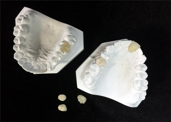 Fácil mantenga el sobrepuesto dental de cerámica blanco del embutido de la chapa de la corona del OEM