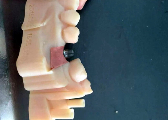 CAD / CAM PFM Coronas dentales Puente Material de resina Buena biocompatibilidad Estabilidad