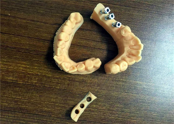 El FDA 3D imprimió la porcelana dental de la corona de los modelos dentales fundida al metal