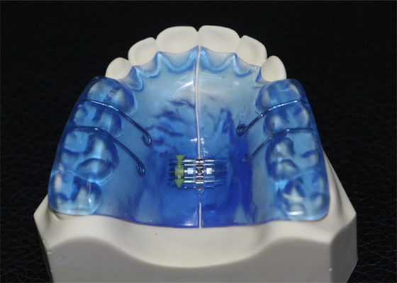 Instrumentos dentales ortopédicos con alta estabilidad y buen Biocompatibility
