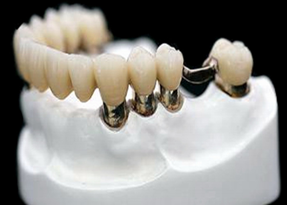 Resistencia a la corrosión de la dentadura del accesorio de la precisión del CR MK1 del CO