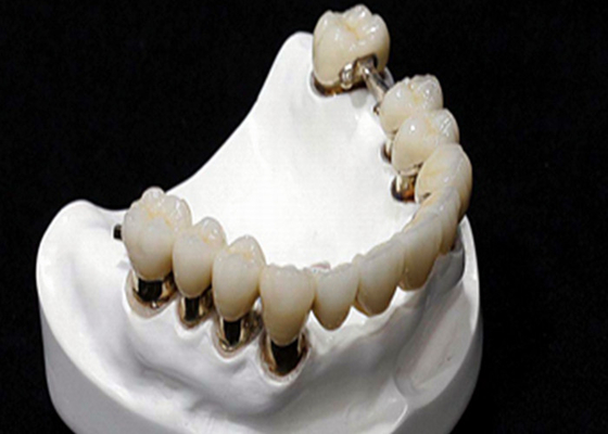 Resistencia a la corrosión de la dentadura del accesorio de la precisión del CR MK1 del CO