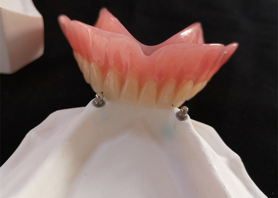 Alto implante de la dentadura CAD-CAM del accesorio de la precisión de Biocompatibility
