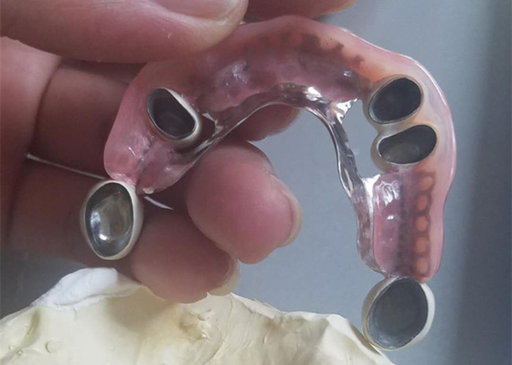 Dentadura durable flexible del accesorio de la precisión resistente a la corrosión