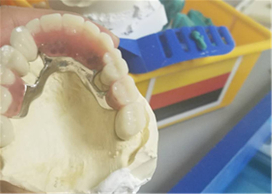 Dentadura durable flexible del accesorio de la precisión resistente a la corrosión