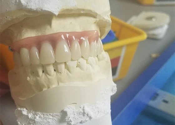 Dentadura durable flexible del accesorio de la precisión resistente a la corrosión